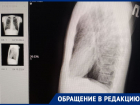 «Ждали 5,5 часов»: волгоградка пожаловалась на отказ врачей принимать ее мужа с куском лома в груди 