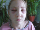 В волгоградском салоне красоты 13-летняя солистка ансамбля получила сильнейший ожог глаз