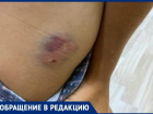 На юге Волгограда собаки покусали 9-летнего мальчика: ребенку колют уколы от бешенства