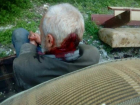 В Волгограде школьник шутки ради пробил камнем голову пенсионеру