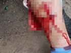 Собака в кровь искусала женщину в Волгограде