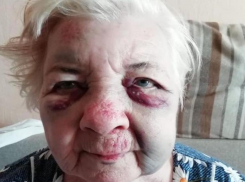84-летнюю избитую волгоградку в 4 утра выставили из областной больницы домой
