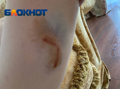 Бездомный пес набросился со спины на волгоградку и прокусил бедро