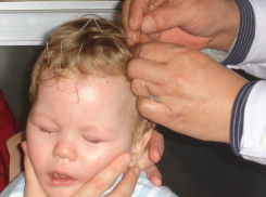 В Волгограде многодетная мать собирает деньги на лечение ребенка в Испании