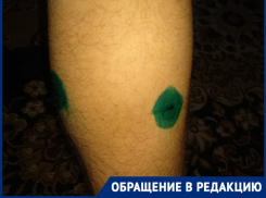 В Волгограде мальчика будут прививать до 2022 года: бродячая собака напала на ребенка