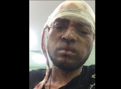 «Я лежал в крови, меня хотят убить»: в Волгограде жестоко избили известного иностранного диджея