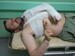 Из-за вооруженного нападения волгоградский художник Митя Зимин лишился возможности работать