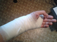 В Волжском хозяин ротвейлера серьезно покусал другого собачника