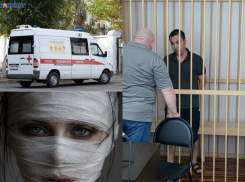 Волгоградку с ожоговым шоком спасают врачи: ее подожгли на улице