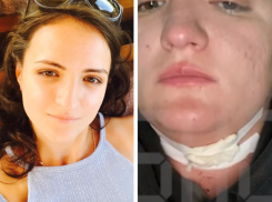 Сотруднице МЧС порезали горло ножом - волгоградка обвиняет в нападении влюбленного коллегу