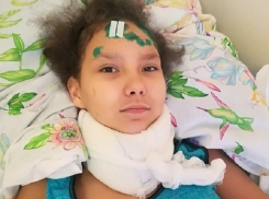 Попавшая в ДТП школьница успела выздороветь, а свидетели получить угрозы, пока волгоградские полицейские возбуждались