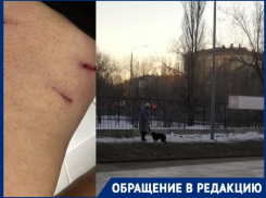 Бездомная собака прогрызла ногу волгоградке у входа в ТЦ: видео