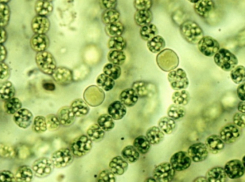 Волгоградцы: вода после дождей заражена смертельно опасными червями 