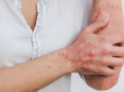 Здесь ваша кожа снова станет здоровой