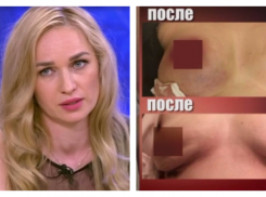 «Звездный» пластический хирург изуродовал грудь многодетной матери из Волгограда