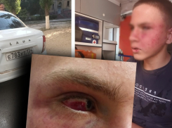 Мать избитого волгоградскими полицейскими школьника лишили возможности разглашать ход следствия