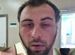 «Подумала, на него напали наркоманы»: волгоградец попал в больницу с сотрясением после полицейского задержания