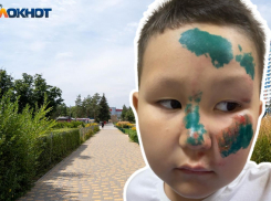 Сбитый электросамокатом 5-летний волгоградец перестал разговаривать и попал в больницу с травмами