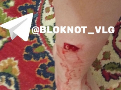 Агрессивная стая искусала до крови ноги волгоградке: 27-летняя отбивалась 