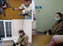 «26 лет проработала на хлебзаводе»: в Волгограде спасают женщину от ампутации ног