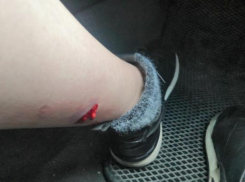 Агрессивные собаки разорвали ногу жительнице Кисловодска в Волгограде