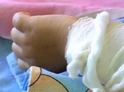 В Волгограде ребенок из многодетной семьи второй раз за год обварился кипятком