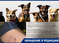 Стая собак набросилась на 9-летнего ребенка в Волгограде