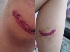 Собаки напали на 9-летнюю школьницу в Волгограде