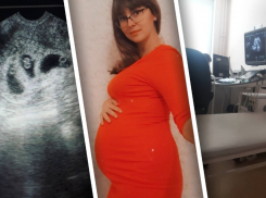 27-летняя волгоградка беременна четырьмя мальчиками: второй подобный случай в регионе
