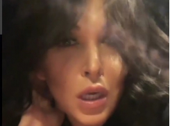 Поклонники обвинили Ирину Дубцову в болезненной увлеченности пластикой