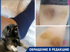«Мило улыбался, пока собака меня грызла»: пес экс-депутата искусал женщину под Волгоградом