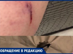 Прокусили ногу и порвали костюм: волжанка показала травмы от нападения бездомных собак