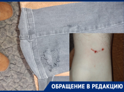 Десятилетнюю девочку отбили из пасти собаки в Волгограде