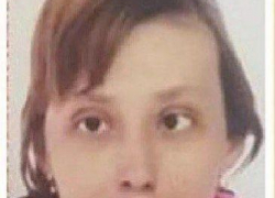 Год разыскивают волгоградку с косоглазием