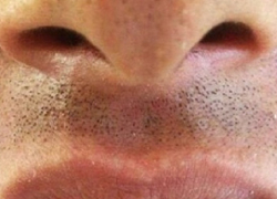 Волгоградец с «акульей челюстью» шокировал Интернет