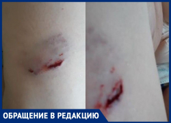 На жительницу Городище у здания прокуратуры набросилась стая бродячих собак: пес разорвал женщине ногу