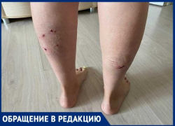 Свора собак искусала волгоградку: девушка закрыла собой коляску с 10-месячной дочкой