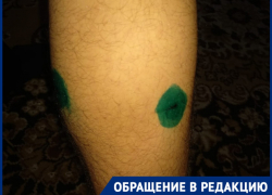 В Волгограде мальчика будут прививать до 2022 года: бродячая собака напала на ребенка