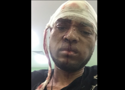 «Я лежал в крови, меня хотят убить»: в Волгограде жестоко избили известного иностранного диджея