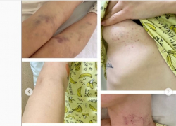 «Тянули волоком полуголую по асфальту»: волгоградка пожаловалось на задержание полицией