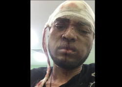 В Астрахани задержали избившего кальяном диджея в Волгограде 