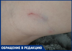 Стая бродячих собак покусала второклассника в "Родниковой Долине" в Волгограде