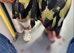 В Волгограде возбудили уголовное дело после нападения бродячих собак на пенсионерку