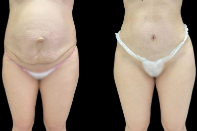 Пастический хирург Нтире Марсело, Клиника «Изабелла» - 