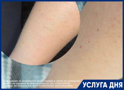 Восковая коррекция волосяного покрова. Новогодняя акция! 