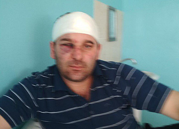 Житель обвинил главу сельской администрации в вооруженном нападении под Волгоградом