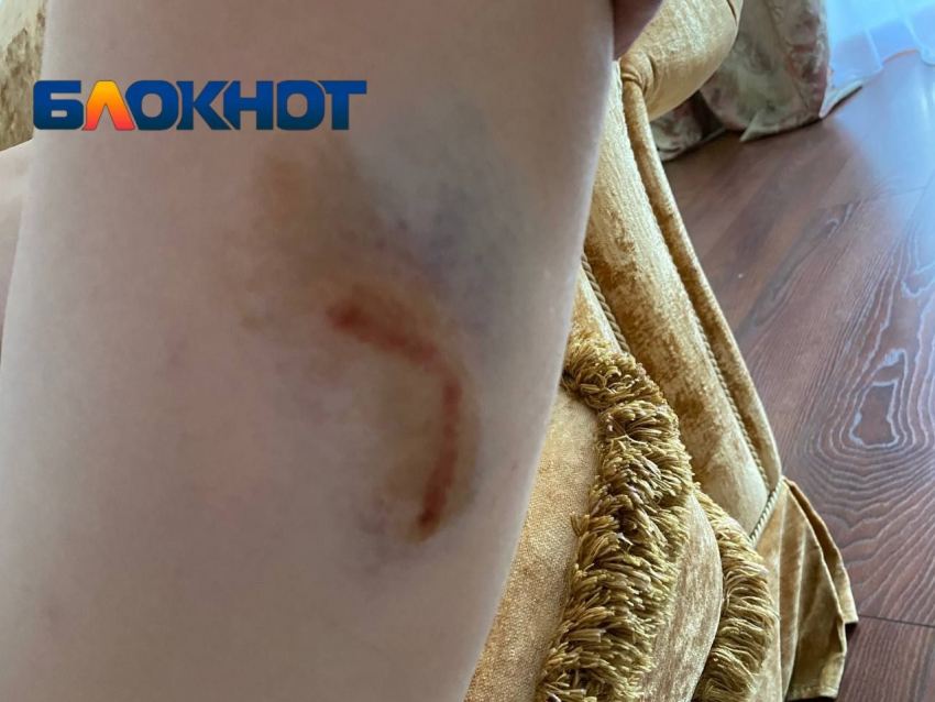 Бездомный пес набросился со спины на волгоградку и прокусил бедро