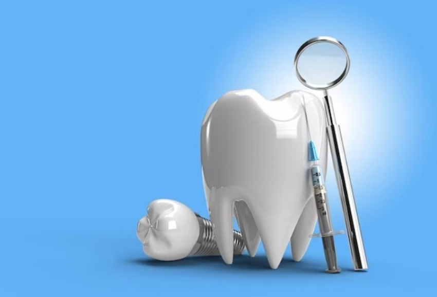 Имплантация зубов в клинике «Эталон» со скидкой 30%