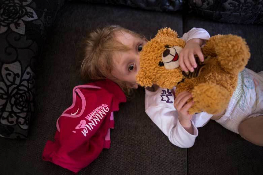 Двухлетней Варе Мачалиной из Волгограда нужно полмиллиона рублей, чтобы выжить