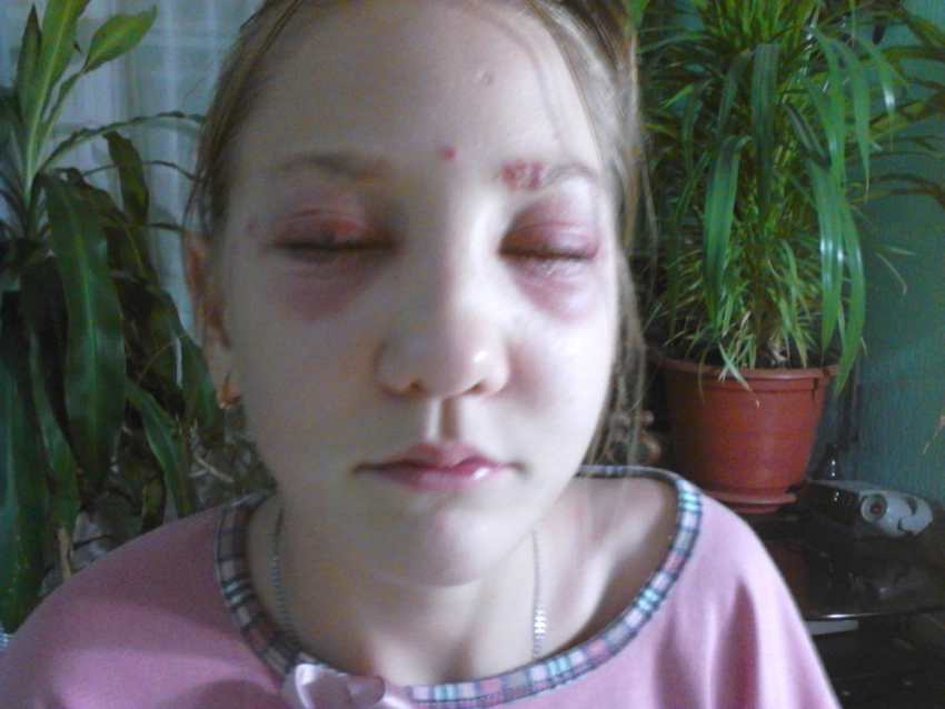 В Волгограде парикмахер наняла двух адвокатов, чтобы не платить ребенку за ожог глаз